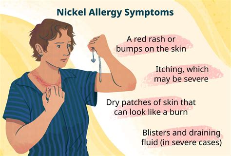 nickel allergen symptome.